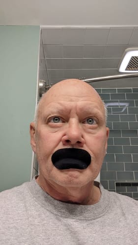 Customer photo review of Mouth Tape customer review