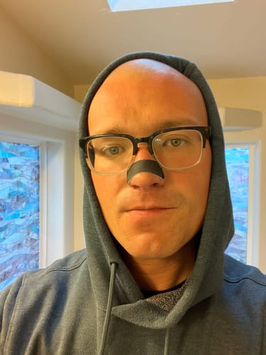 Customer photo review of Nose Strips customer review