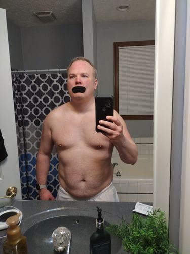 Customer photo review of Mouth Tape customer review
