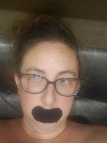 Customer photo review of Mouth Tape customer review