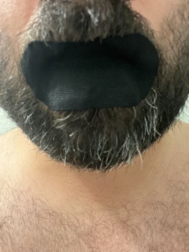 Customer photo review of Mouth Tape customer review