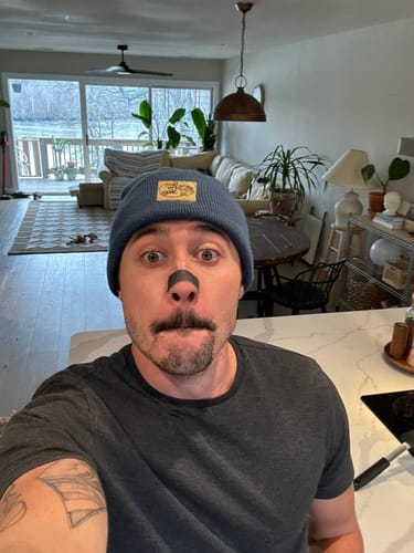 Customer photo review of Nose Strips customer review
