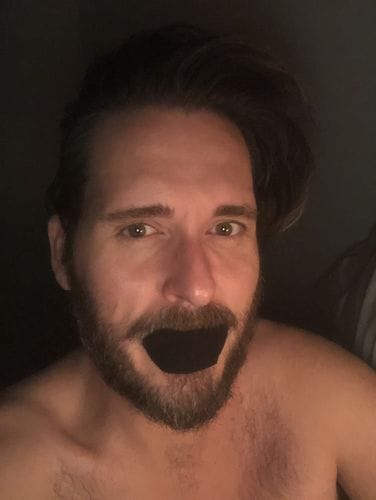 Customer photo review of Mouth Tape customer review
