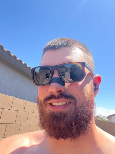 Customer photo review of Nose Strips customer review