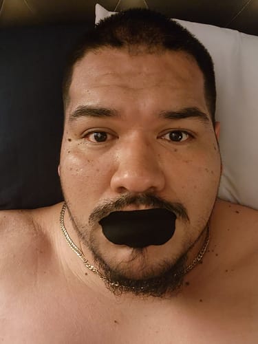 Customer photo review of Mouth Tape customer review
