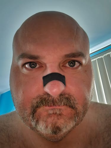Customer photo review of Nose Strips customer review
