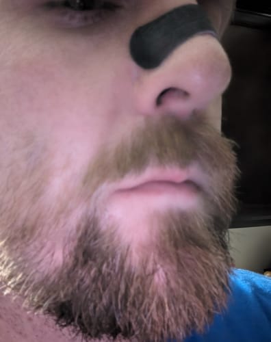 Customer photo review of Nose Strips customer review