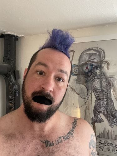 Customer photo review of Mouth Tape customer review