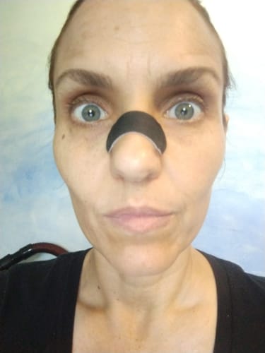 Customer photo review of Nose Strips customer review