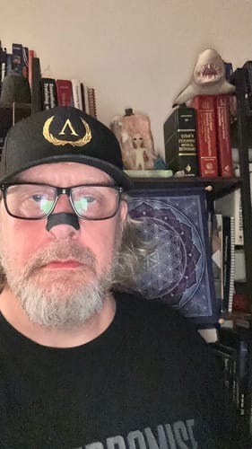 Customer photo review of Nose Strips customer review