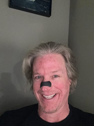 Customer photo review of Nose Strips customer review