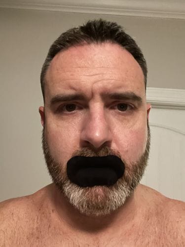 Customer photo review of Mouth Tape customer review
