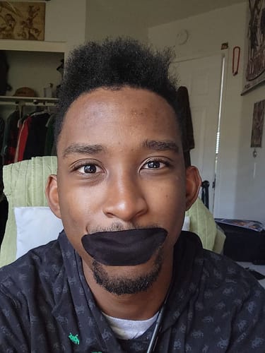 Customer photo review of Mouth Tape customer review