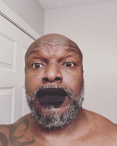 Customer photo review of Mouth Tape customer review