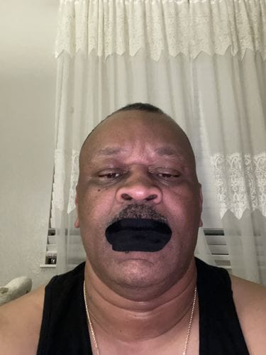 Customer photo review of Mouth Tape customer review