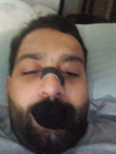 Customer photo review of Nose Strips customer review