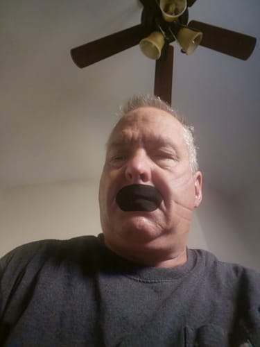 Customer photo review of Mouth Tape customer review
