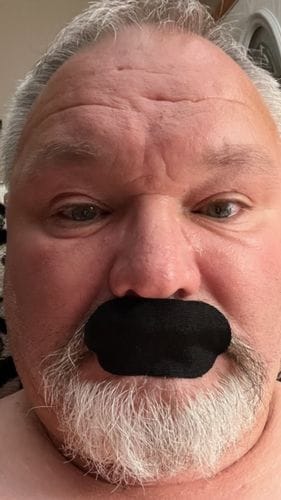 Customer photo review of Mouth Tape customer review