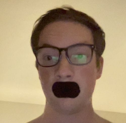 Customer photo review of Mouth Tape customer review