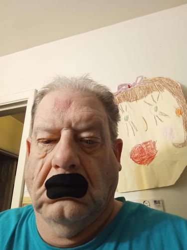 Customer photo review of Mouth Tape customer review