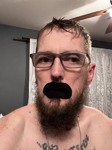 Customer photo review of Mouth Tape customer review