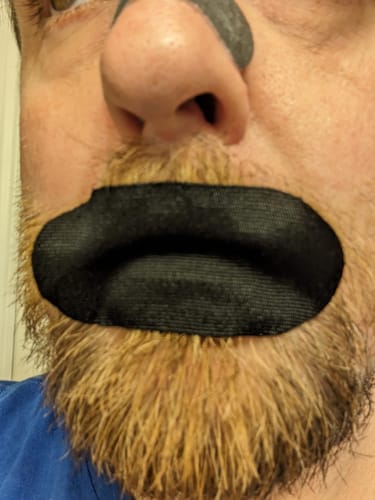 Customer photo review of Nose Strips customer review