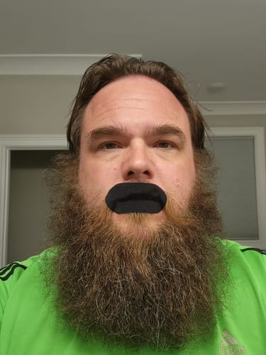 Customer photo review of Mouth Tape customer review
