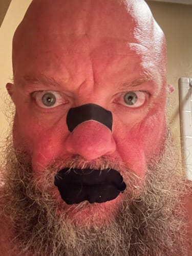 Customer photo review of Nose Strips customer review