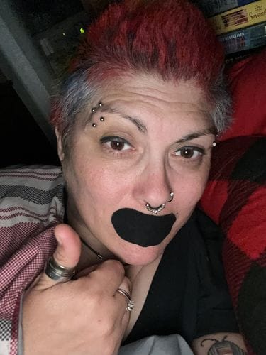 Customer photo review of Mouth Tape customer review