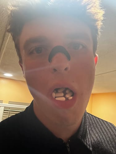 Customer photo review of Nose Strips customer review