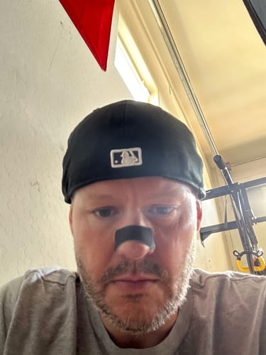Customer photo review of Nose Strips customer review