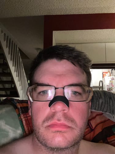 Customer photo review of Nose Strips customer review