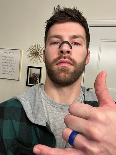 Customer photo review of Nose Strips customer review