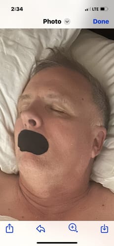 Customer photo review of Mouth Tape customer review