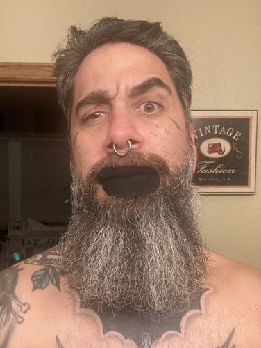 Customer photo review of Mouth Tape customer review